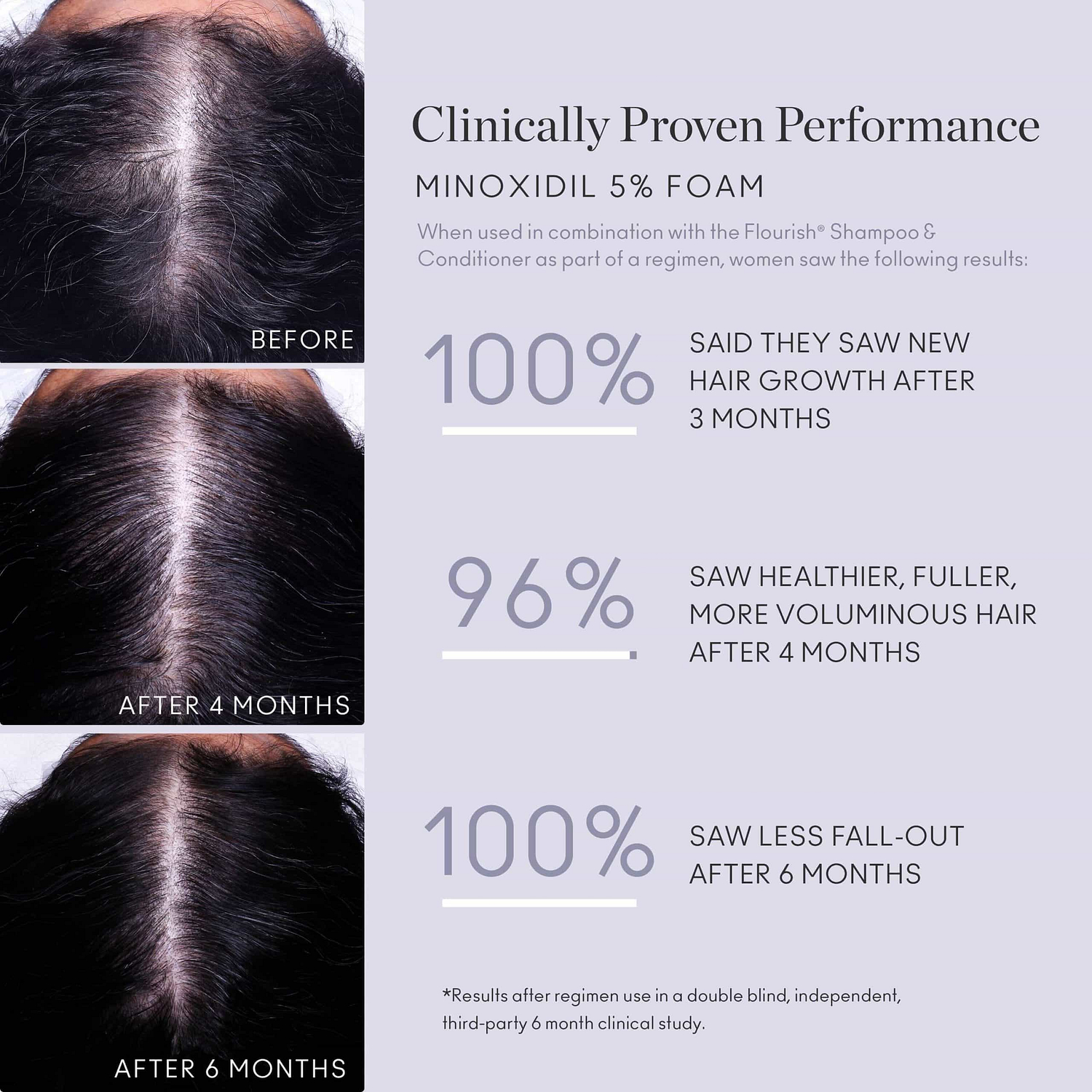 Virtue Flourish Hair Treatment - 5% Minoxidil for Thinning Hair HAIRSHOP